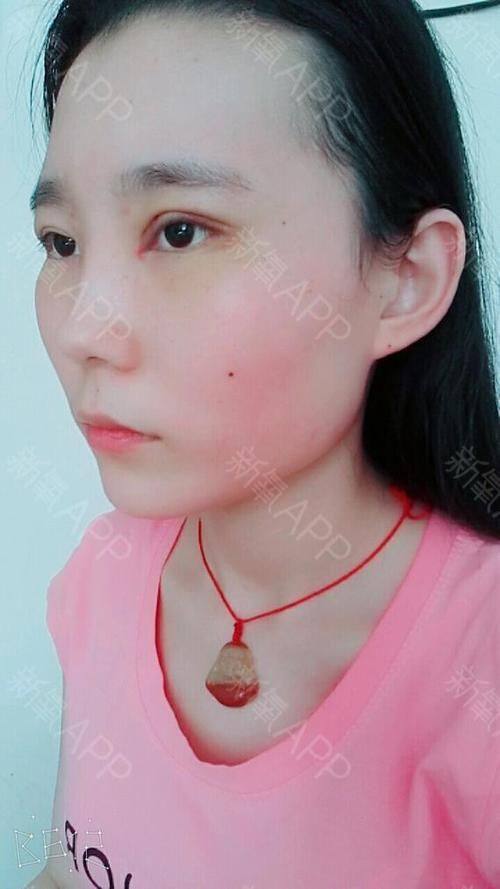 韩国延世罗姿丽（Yonsei Roseelle）医院收费价格表/收费标准