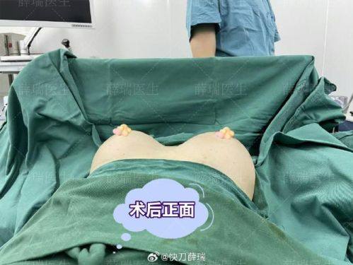 温州艺美整形美容医院特色项目及技术优势