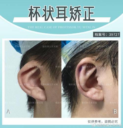 韩国延世罗姿丽（Yonsei Roseelle）医院真人口碑评价怎么样？