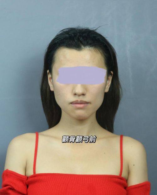 河北沧州红提医疗整形医院收费价格表/收费标准