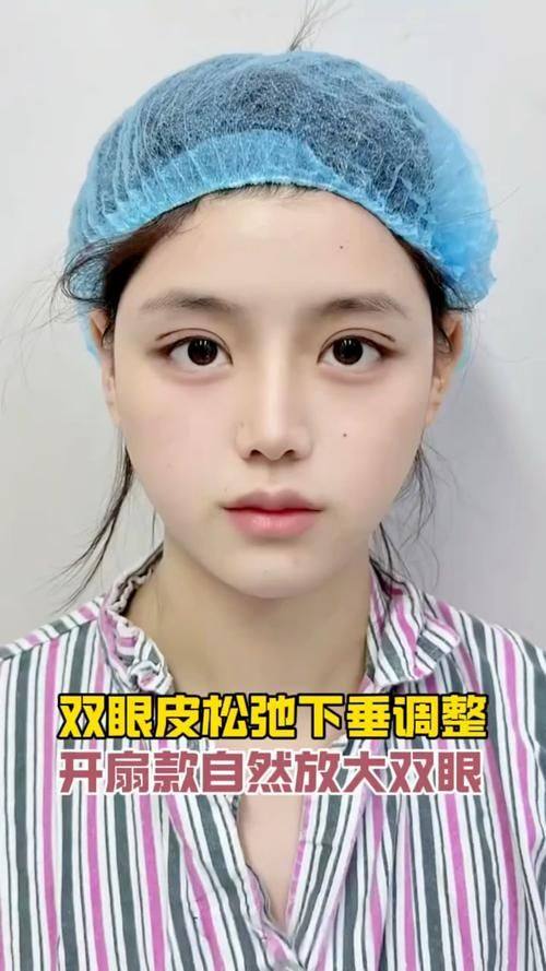 河北沧州红提医疗整形医院真人口碑评价怎么样？