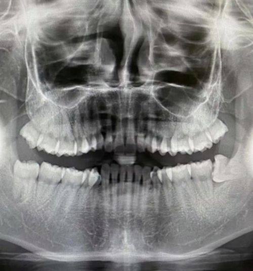 海口秀英简爱芽口腔门诊部详细的预约挂号方式及流程