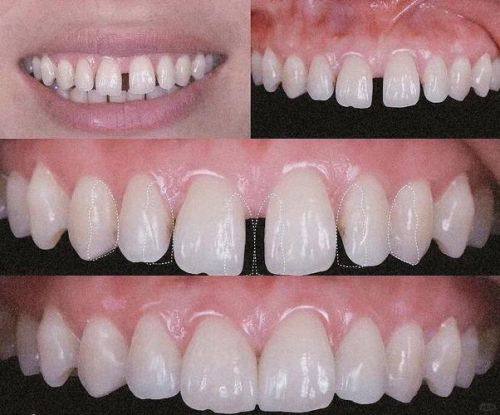 历下诺雅口腔诊所地址电话营业时间