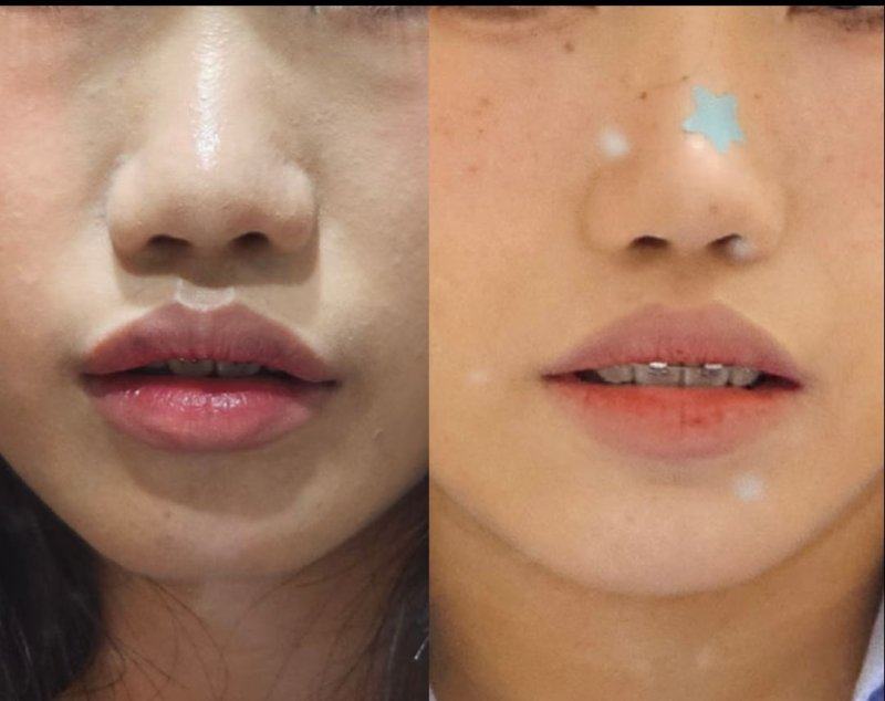 口碑评价及真人实例