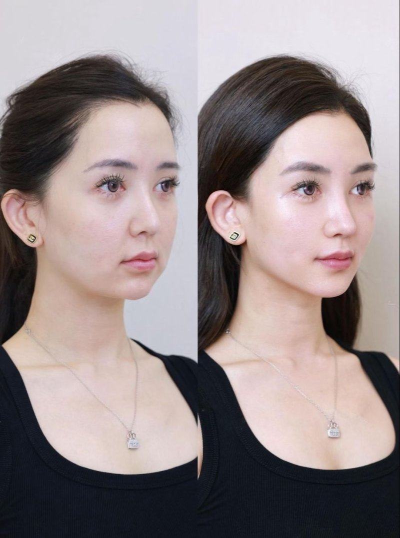 河北沧州红提医疗整形医院地址电话营业时间