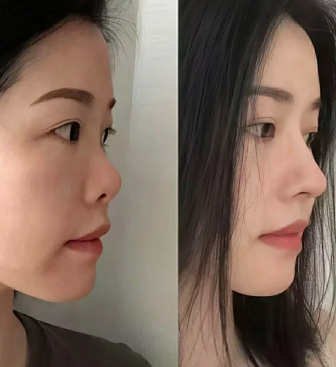 口碑评价及真人实例