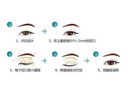 重庆赛格尔整形美容医院详细的预约挂号方式及流程