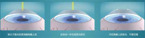 昆明阿玛施眼科门诊部地址电话营业时间