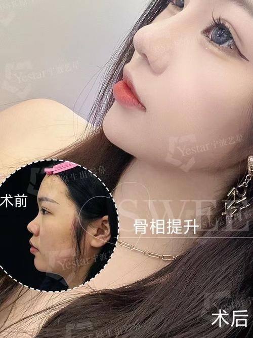 柳超医生预约挂号