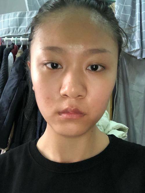 盘锦星美御颜整形医院特色项目及技术优势