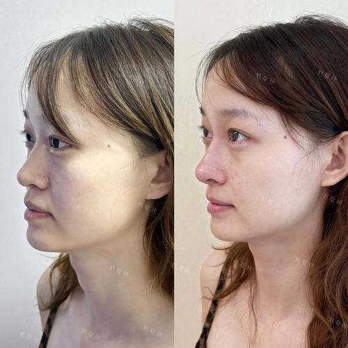 南昌智美医疗美容门诊部特色项目及技术优势