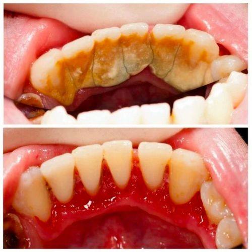 云南个旧臣康口腔特色项目及技术优势