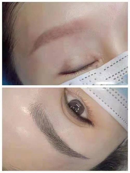 临沂艺生医疗美容门诊部收费价格表/收费标准