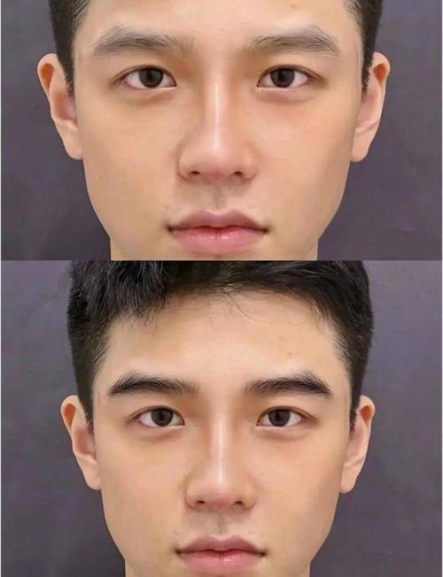 临沂艺生医疗美容门诊部真人口碑评价怎么样？