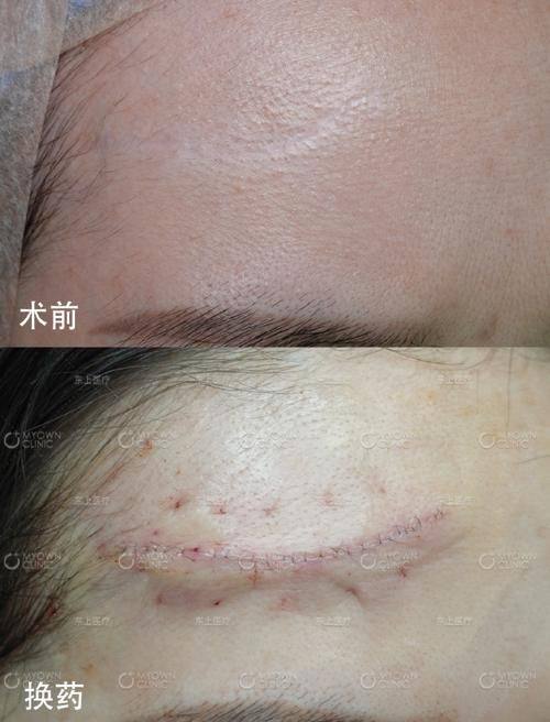 盘锦星美御颜整形医院真人口碑评价怎么样?