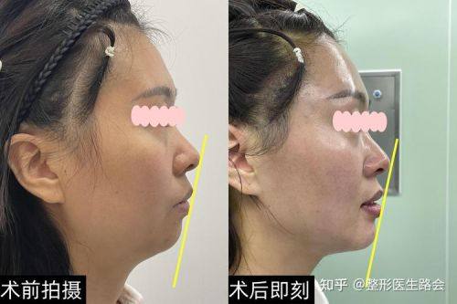 重庆赛格尔整形美容医院是正规医院吗？