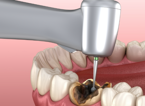 袁惠玲医生擅长项目