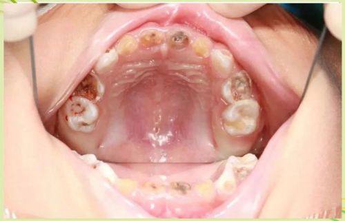 口碑评价及真人实例