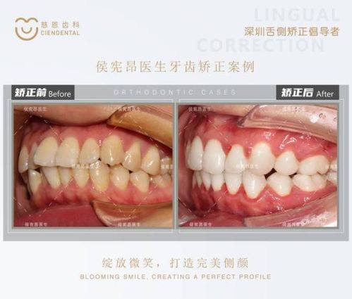 毛治军 医生技术优势