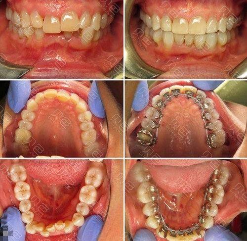 毛治军 医生擅长项目