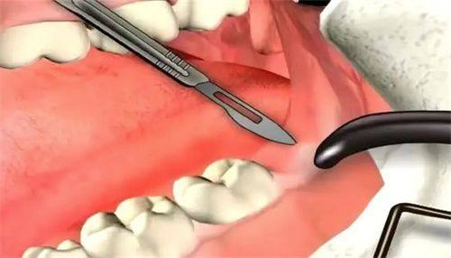 景德镇昌洪口腔医院有限公司特色项目及技术优势