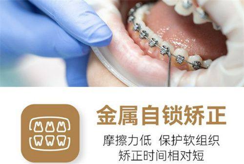 杭州楷林口腔门诊部是正规医院吗？