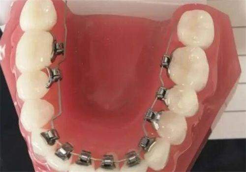 杭州楷林口腔门诊部真人口碑评价怎么样？