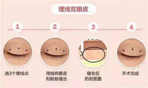 南京美好尉来医美整形医生团队实力强大及骨干医生简介