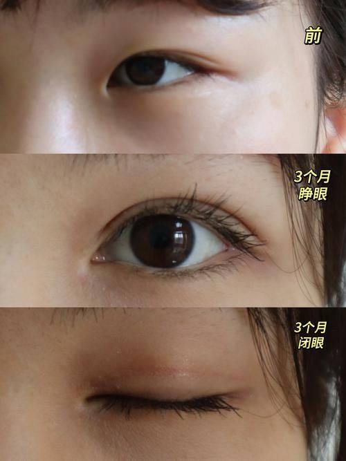 徐州王莹整形医疗美容诊所收费价格表/收费标准