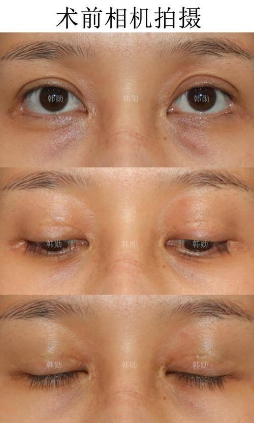 韩国SoonPlus整形外科医院医生团队实力强大及骨干医生简介