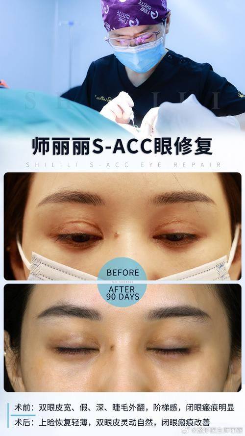 韩国SoonPlus整形外科医院是正规医院吗？