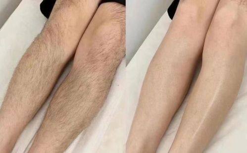 安徽合肥普睿媞整形医院真人口碑评价怎么样?