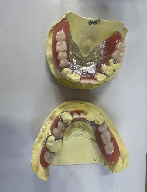 西安百思美口腔真人口碑评价怎么样？