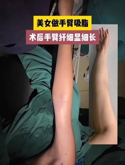 呼和浩特市闫小林医疗美容门诊部真人口碑评价怎么样?