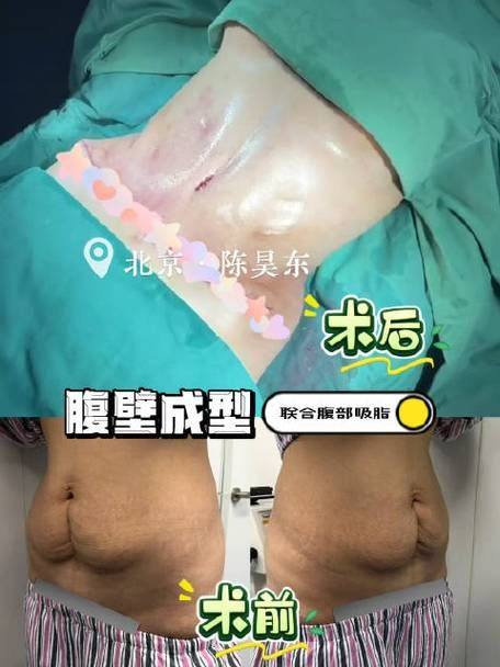 安徽合肥普睿媞整形医院是正规医院吗?