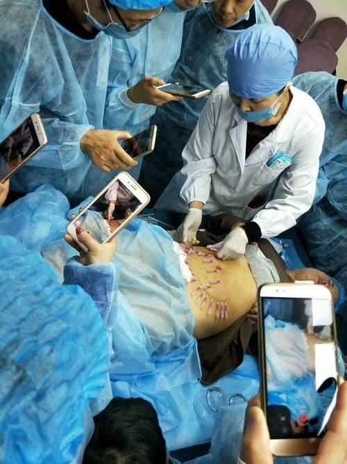 徐州王莹整形医疗美容诊所真人口碑评价怎么样?