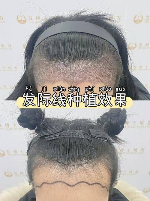 安徽合肥普睿媞整形医院地址电话营业时间