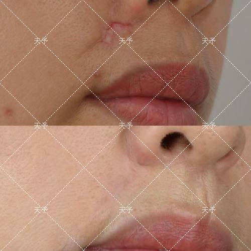 徐州王莹整形医疗美容诊所是正规医院吗?