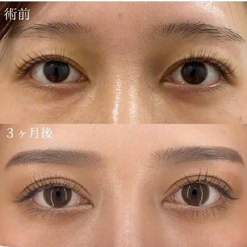 韩国SoonPlus整形外科医院真人口碑评价怎么样？