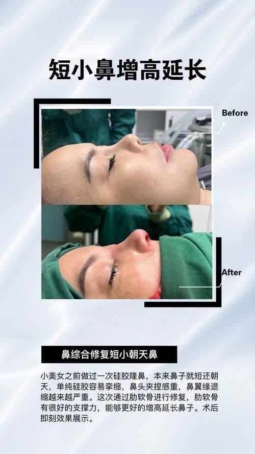 南京美好尉来医美整形特色项目及技术优势