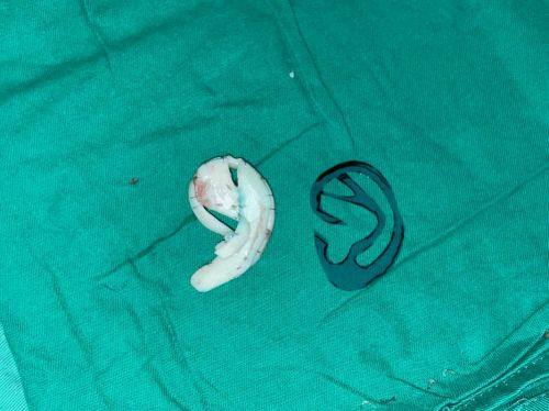 通化张玉发整形医疗美容诊所详细的预约挂号方式及流程