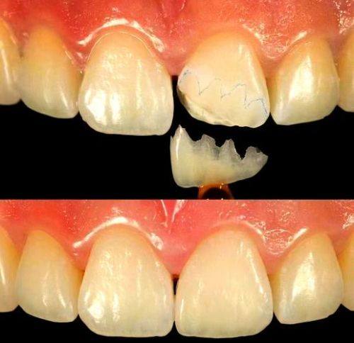 浙江温州乐清欣雅口腔真人口碑评价怎么样？