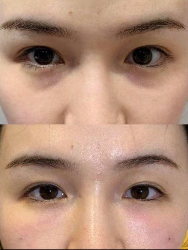 南京美好尉来医美整形真人口碑评价怎么样？