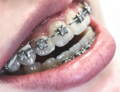 杭州楷林口腔门诊部地址电话营业时间