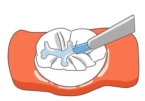杭州舒亚口腔诊所收费价格表/收费标准