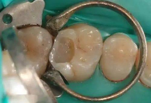 西宁博强口腔门诊部是正规医院吗?