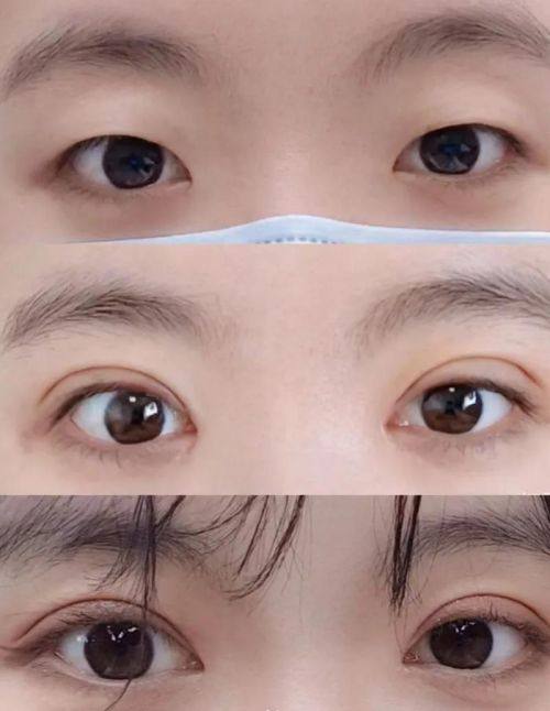 大连春柳整形医疗美容诊所是正规医院吗?