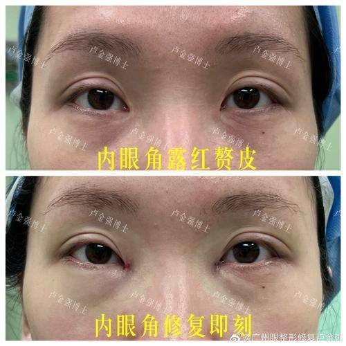 大连春柳整形医疗美容诊所详细的预约挂号方式及流程