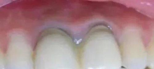 杭州舒亚口腔诊所真人口碑评价怎么样?