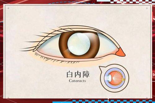 北京宁联西海眼科真人口碑评价怎么样?